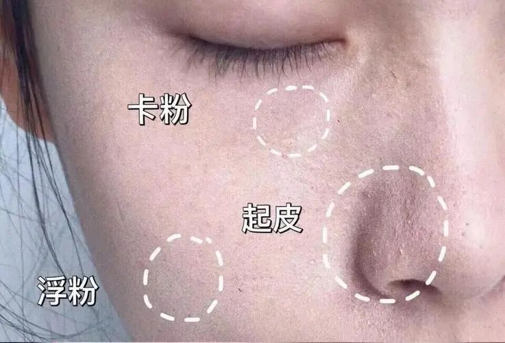 冬季上底妝容易出現的問題 冬季上底妝注意事項有哪些?