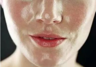 不同膚質(zhì)應該如何正確護膚？