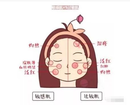 不同膚質(zhì)應該如何正確護膚？