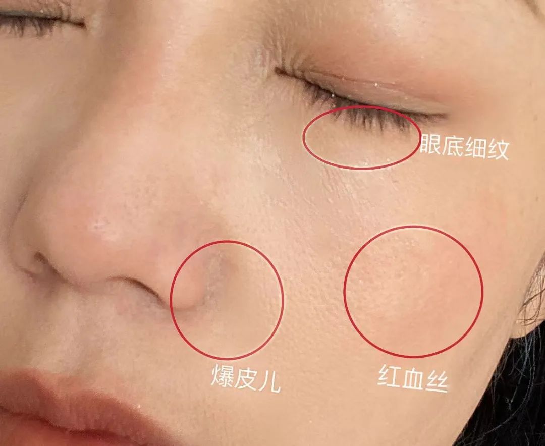 如何判斷自己是不是干敏肌膚？干敏肌有哪些特征？