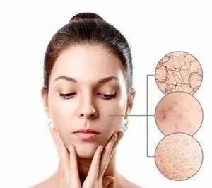 什么是春敏？如何預(yù)防春敏？