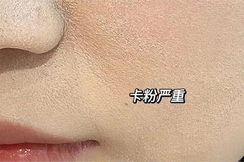 卡粉 卡粉是什么意思?卡粉是什么原因引起的?