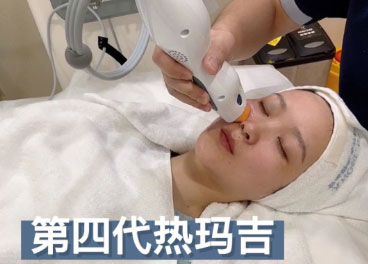 熱瑪吉美容項目 熱瑪吉的效果可以維持多久?熱瑪吉的效果可以保持一年嗎?