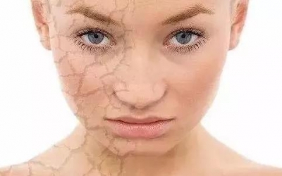 肌膚刺癢是什么原因？是哪些因素造成肌膚刺癢的現象？