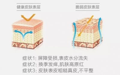 敏感肌與過敏肌的區別是什么？