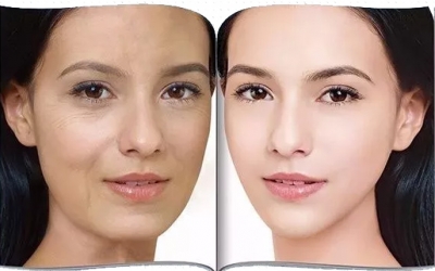 女性抗衰老最好的方法是什么？