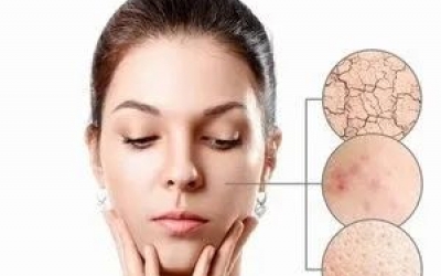 什么是春敏？如何預防春敏？